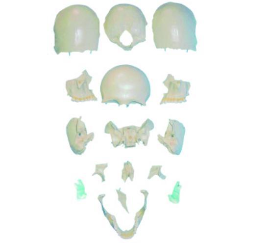 康人分離頭顱骨散骨模型KAR/11117-2