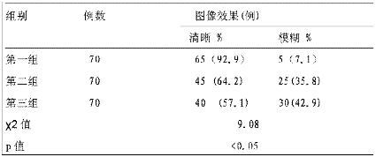 心電監(jiān)護(hù)不同位置電極片效果觀察