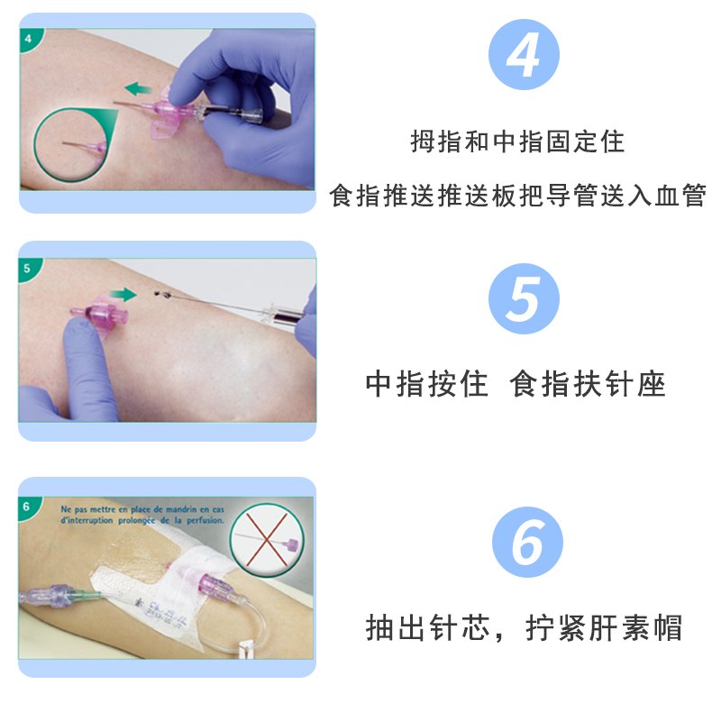 德國(guó)貝朗 Introcan-W 英初康 動(dòng)靜脈留置針（帶翼） 