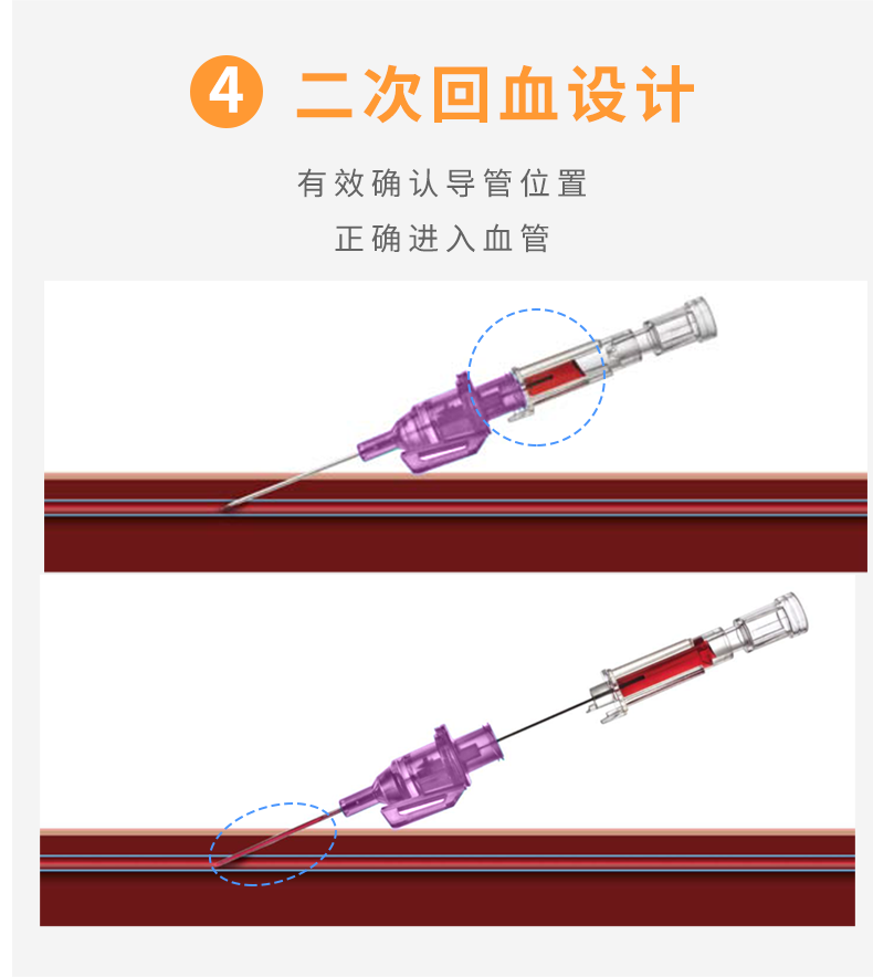 英全康20G動(dòng)靜脈留置針