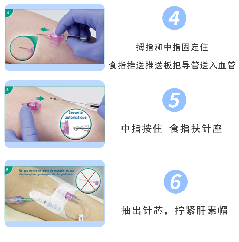 英全康20G動(dòng)靜脈留置針