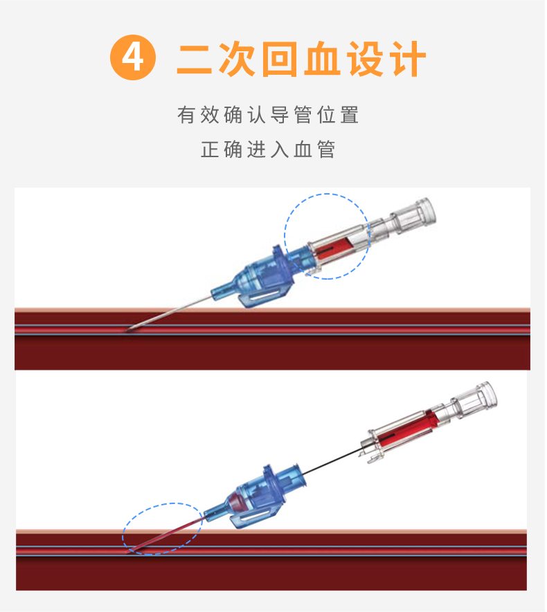 英全康22G動靜脈留置針